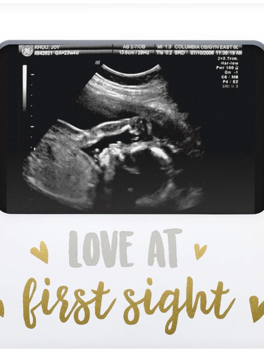 Love at First Sight White Sonogram Keepsake Frame